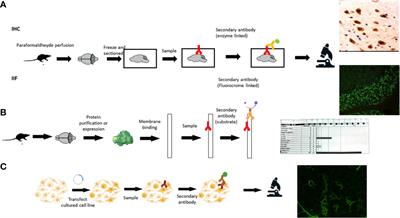 The study of neural antibodies in neurology: A practical summary